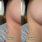 Nevara Under-Bust Relief Cream